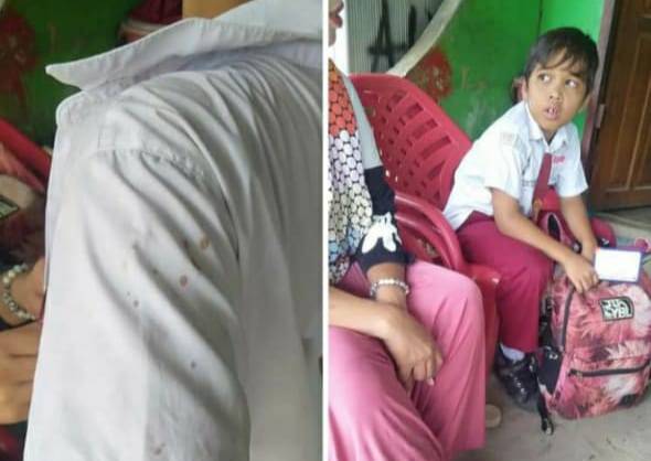 Vaksinasi di SDN 112259 Guntingsaga Tanpa Pendampingan Orangtua, Ada yang Berdarah-darah