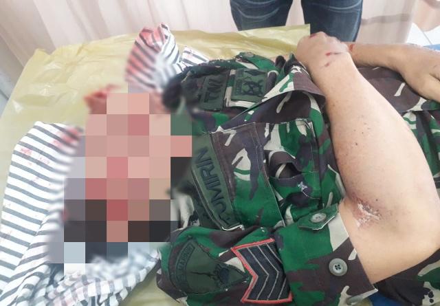 Anggota TNI AL Belawan Tewas di Tempat Ditabrak Tronton 