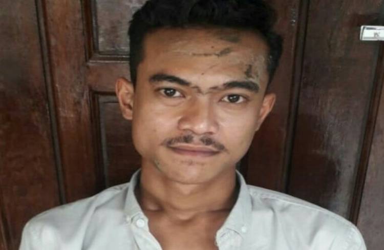 Polda Sumut Buru Pelaku Pemukulan Aktivis HMI di Langkat