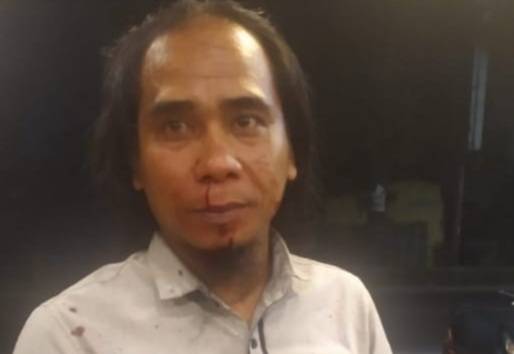 Aktivis Anti Korupsi di Sumut Dikroyok 3 Pelaku Suruhan Koruptor