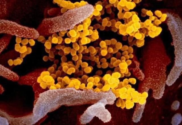 Pasien Positif Corona di Batam Meninggal Dunia