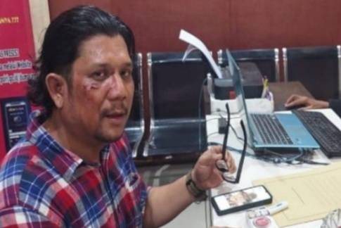 Kuasa Hukum Pelaku Jangan Buat Framming yang Bisa Buat Gaduh