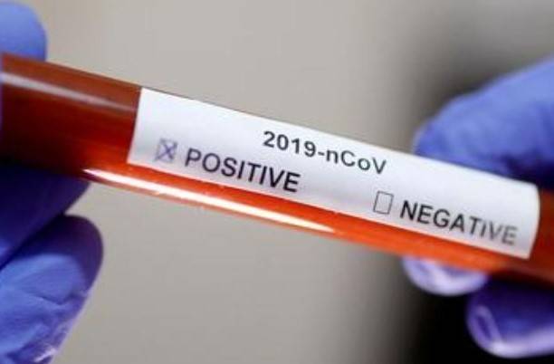 Meski Kondisi Normal dan Sehat, Seorang Warga Asahan Dinyatakan Positif Corona