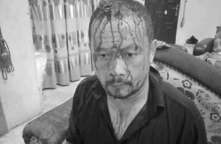 Pengurus BKM Baiturrahman Kwala Begumit Bonyok Dipukuli Maling Kotak Infak