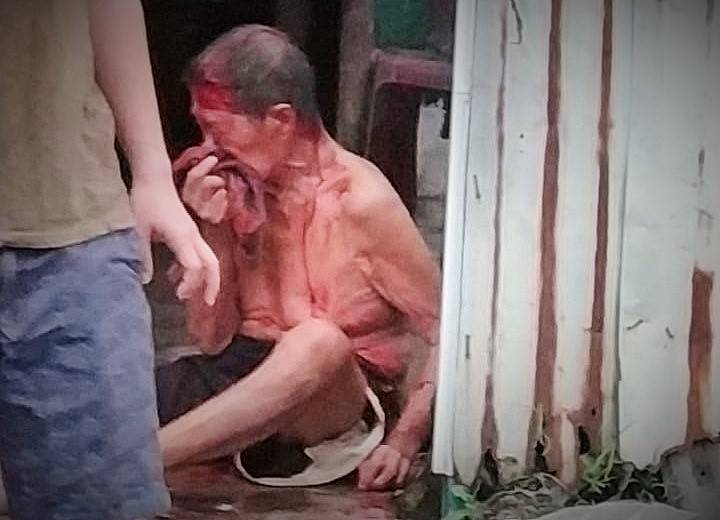 Ayah dan Anak Luka Bacok jadi Korban Rampok di Medan