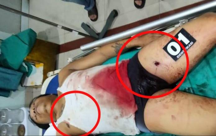 Wartawan Tewas Ditembak OTK di Siantar
