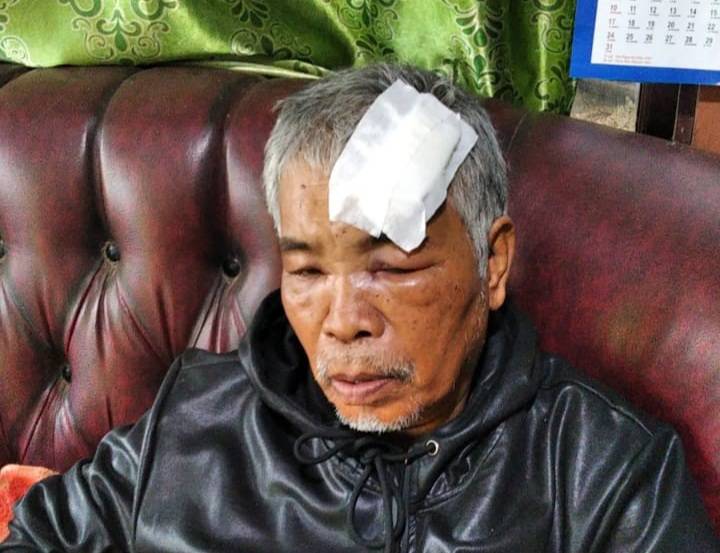 Ayah dan 2 Anak Dilaporkan ke Polres Taput, Korban Minta Pelaku Segera Ditangkap