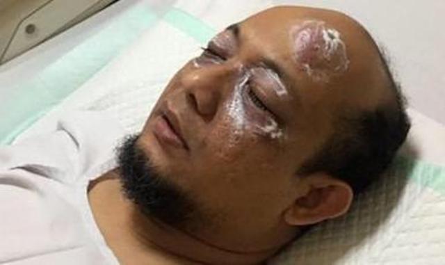 Satgas Kasus Novel Baswedan Gagal!