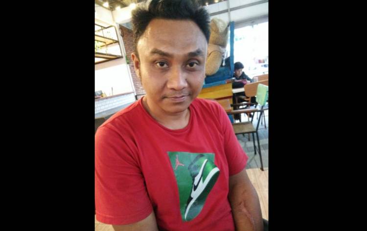 Disiksa Hingga Memar, Korban Salah Tangkap Polsek Sunggal Lapor ke Polda Sumut