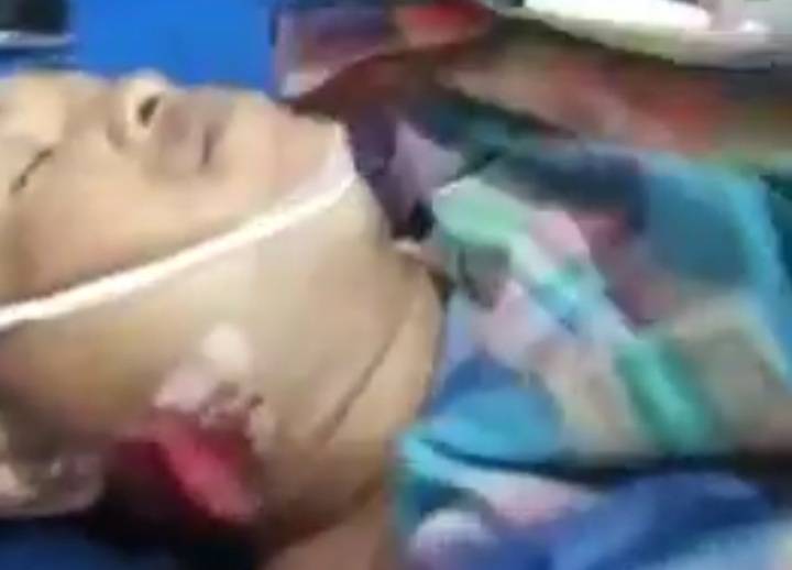 Diklaim Bandar Barkoba, Nasib Tewas Ditembak Polisi Belawan di Leher