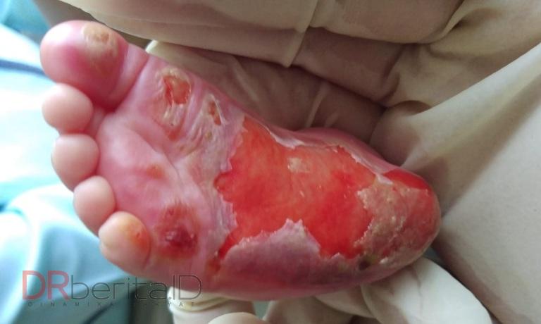 Akibat Program Stunting Pemerintah, Bayi dari Anggota Demokrat Sumut Jadi Korban Dugaan Malpraktek