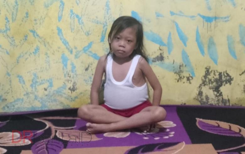 Andini Fitri, Penderita Thalasemia di Medan Butuh Pertolongan Dermawan