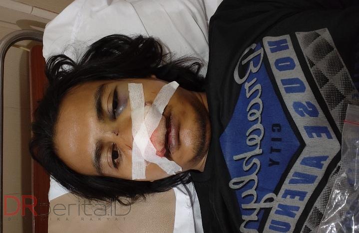 Sopir Ojol Bingung Surat Kenderaan Ditahan Polsek Medan Baru, Mau Cari Uang Tak Bisa