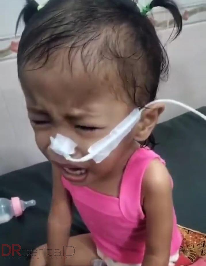 Arisha Nasution, Bocah 2 Tahun yang Melawan Kebocoran di Sekat Jantung
